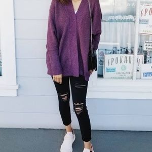 TOPSHOP Jamie Skinny Jeans